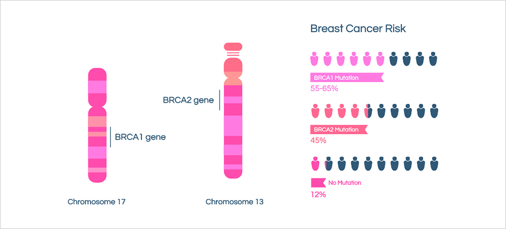 BRCA Mutations and Breast Cancer
